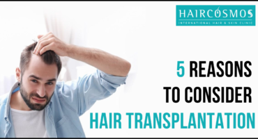 5-reasons-to-consider-hair-transplantation