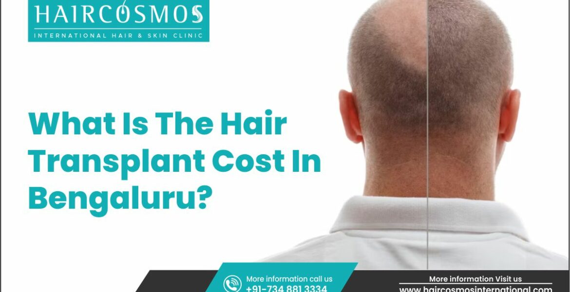 Hair Transplant Cost In Bangalore