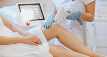 Permanent laser hair removal for legs