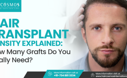 "Hair transplant density guide with graft count and coverage"