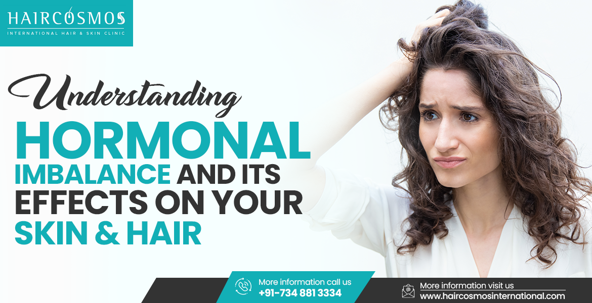 Hormonal imbalance affecting skin and hair health in men and women