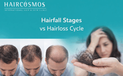 Hairfall stages vs. hair loss cycle