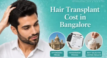 hair-transplant-cost-bangalore