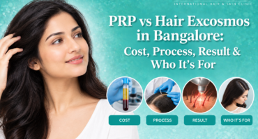 PRP vs Hair Exosomes